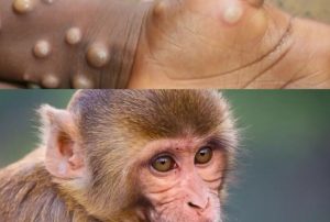 މަންކީޕޮކްސްގެ ދިވެހި ނަމަކީ "މަކުނު ވިދުރި"