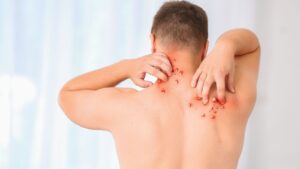 މަކުނުވިދުރި ފެތުރެމުންދަނީ އެއްޖިންސުން ގުޅުން ހިންގާ ފިރިހެނުންގެ މެދުގައި! ފާޙިޝް އަމަލުތަކާ ދުރުހެލިވޭ!