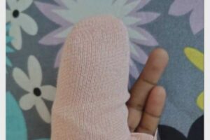 ތ. ކަނޑޫދޫ ސްކޫލްގައި ދަރިވަރެއްގެ އިނގިލި އަނބުރާލި މައްސަލާގައި ބިދޭސީ ޓީޗަރު ހައްޔަރުކޮށްފި