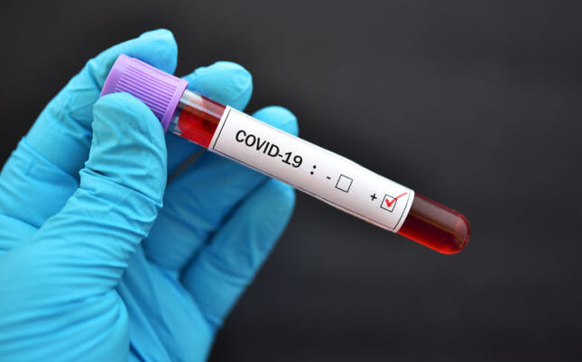 ކޯވިޑް-19: 2،000 އަށްވުރެ ގިނަ ސާމްޕަލުން މިއަދު ޕޮޒިޓިވްވީ 8 މީހުން