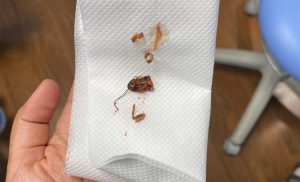 އައިޖީއެމްއެޗްގައި މީހެއްގެ ކަންފަތުން ކުރަތްޕެއް ނަގައިފި