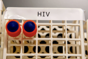 ސްޓެމް ސެލް ޓްރާންސްޕްލާންޓު ހެދި އަންހެނަކު އެއިޑްސް ބަލިން ރަގަޅު ވެއްޖެ