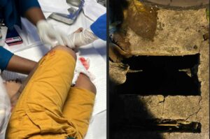 4 އަހަރުގެ ކުޑަކުއްޖަކު ކާނުގަނޑެެއް ތެރެއަށް ވެއްޓި ޒަހަމުވެއްޖެ