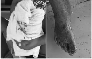 ކަންނެލި ދޯންޏަކުން މޫދަށް ވެއްޓުނު މީހަކަށް މިޔަރެއް ހަމަލާދީފި