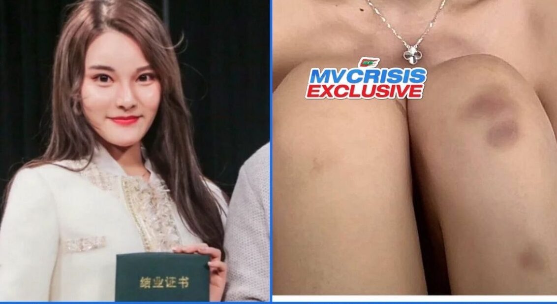 ރިސޯޓެއްގައި ފަތުރުވެރިއަކު ރޭޕްކުރި މައްސަލައެއް ބަލަނީ