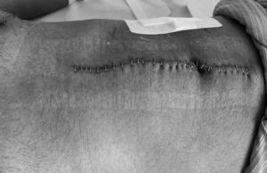 ނަޝީދު އަވަހާރަކޮށްލަން ދިން ހަމަލާއަށް އިންސާފު ނުލިބުމަކީ ލަދުވެތި ކަމެއް: ޑިމޮކްރެޓްސް