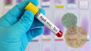 އިންޑިއާއިން ނިޕާ ވައިރަސް ފެނުނު ނަމަވެސް ރާއްޖެއަށް ނުރައްކާ ކުޑަ: އެޗްޕީއޭ