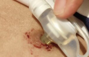 ހޮޅިކޮޅު ނުލިބި ކުއްޖަކު ނިޔާވި މައްސަލަ: ސިޔާސީ ބޭނުމަށް ކުއްޖާގެ ފޮޓޯ ބޭނުންނުކުރަން އަންގައިފި