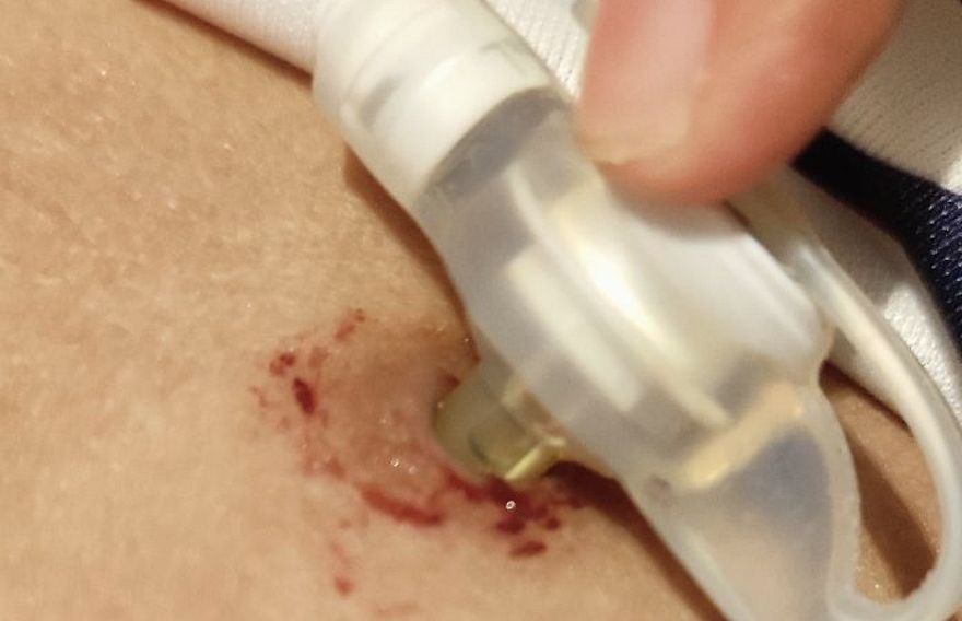 ހޮޅިކޮޅު ނުލިބި ކުއްޖަކު ނިޔާވި މައްސަލަ: ސިޔާސީ ބޭނުމަށް ކުއްޖާގެ ފޮޓޯ ބޭނުންނުކުރަން އަންގައިފި